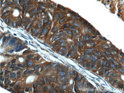 TMPRSS4 Rabbit anti-Human, Rat, Polyclonal, Proteintech 150 &mu;L; Unconjugated:Antibodies,