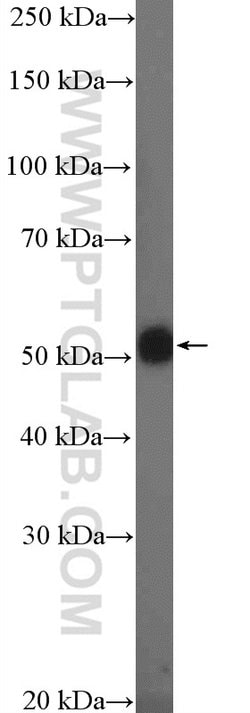 TMPRSS4 Rabbit anti-Human, Rat, Polyclonal, Proteintech 150 &mu;L; Unconjugated:Antibodies,
