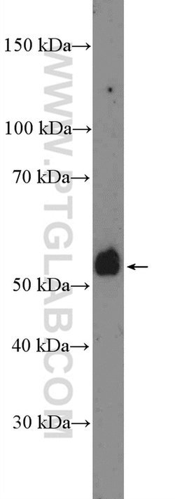 TMPRSS4 Rabbit anti-Human, Rat, Polyclonal, Proteintech 150 &mu;L; Unconjugated:Antibodies,
