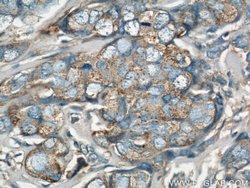 EIF3I Rabbit anti-Human, Mouse, Rat, Polyclonal, Proteintech:Anticuerpos:Anticuerpos