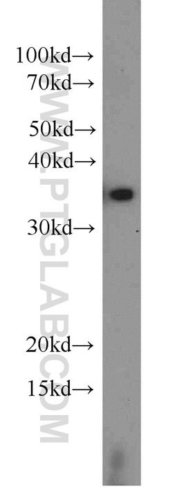 EIF3I Rabbit anti-Human, Mouse, Rat, Polyclonal, Proteintech:Anticuerpos:Anticuerpos