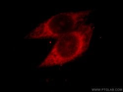 PARP3 Rabbit anti-Human, Mouse, Rat, Polyclonal, Proteintech:Antibodies:Primary