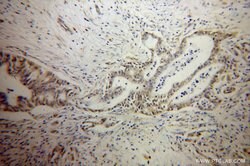 PARP3 Rabbit anti-Human, Mouse, Rat, Polyclonal, Proteintech:Antibodies:Primary