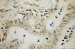 PARP3 Rabbit anti-Human, Mouse, Rat, Polyclonal, Proteintech:Antibodies:Primary