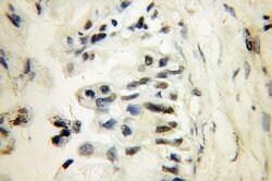 PARP3 Rabbit anti-Human, Mouse, Rat, Polyclonal, Proteintech:Antibodies:Primary