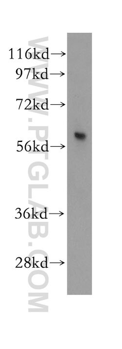 PARP3 Rabbit anti-Human, Mouse, Rat, Polyclonal, Proteintech:Antibodies:Primary