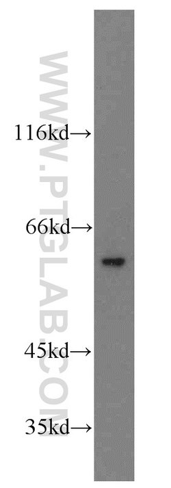 PARP3 Rabbit anti-Human, Mouse, Rat, Polyclonal, Proteintech:Antibodies:Primary