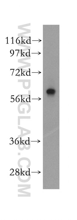 PARP3 Rabbit anti-Human, Mouse, Rat, Polyclonal, Proteintech:Antibodies:Primary