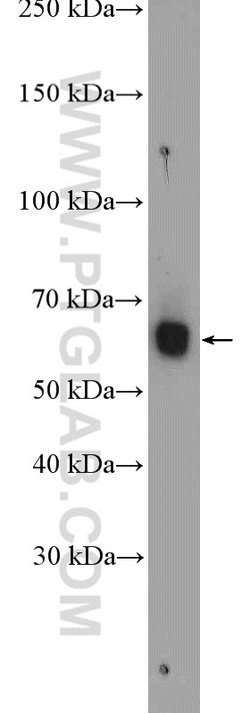 PARP3 Rabbit anti-Human, Mouse, Rat, Polyclonal, Proteintech:Antibodies:Primary