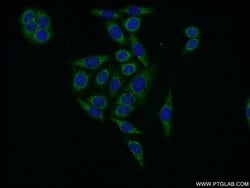 EIF2B3 Rabbit anti-Human, Mouse, Rat, Polyclonal, Proteintech:Antibodies:Primary