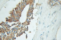 EIF2B3 Rabbit anti-Human, Mouse, Rat, Polyclonal, Proteintech:Antibodies:Primary