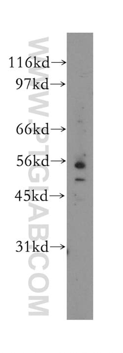 EIF2B3 Rabbit anti-Human, Mouse, Rat, Polyclonal, Proteintech:Antibodies:Primary