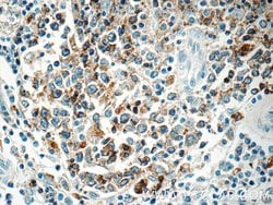 HLA-DPB1 Rabbit anti-Human, Polyclonal, Proteintech 150 &mu;L; Unconjugated:Antibodies,