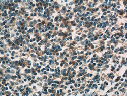 HLA-DPB1 Rabbit anti-Human, Polyclonal, Proteintech 150 &mu;L; Unconjugated:Antibodies,
