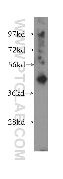 P2RY6 Rabbit anti-Human, Mouse, Rat, Polyclonal, Proteintech:Antibodies:Primary
