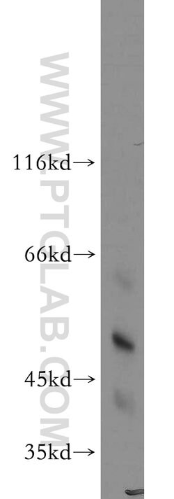 HARS2 Rabbit anti-Human, Mouse, Rat, Polyclonal, Proteintech 150 &mu;L;