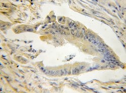 STMN3 Rabbit anti-Human, Mouse, Rat, Polyclonal, Proteintech 150 &mu;L;
