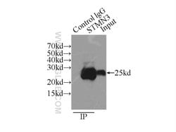 STMN3 Rabbit anti-Human, Mouse, Rat, Polyclonal, Proteintech 150 &mu;L;