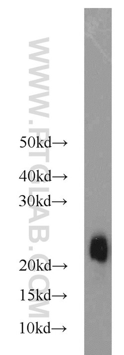 STMN3 Rabbit anti-Human, Mouse, Rat, Polyclonal, Proteintech