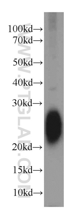 STMN3 Rabbit anti-Human, Mouse, Rat, Polyclonal, Proteintech 150 &mu;L;