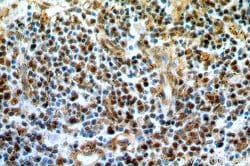 IRF3 Rabbit anti-Human, Mouse, Rat, Polyclonal, Proteintech:Antibodies:Primary
