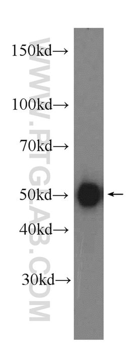 IRF3 Rabbit anti-Human, Mouse, Rat, Polyclonal, Proteintech:Antibodies:Primary