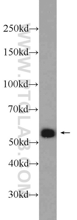 IRF3 Rabbit anti-Human, Mouse, Rat, Polyclonal, Proteintech:Antibodies:Primary