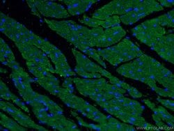 alpha Actinin Rabbit anti-Human, Mouse, Rat, Polyclonal, Proteintech:Anticorps:Anticorps