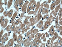 alpha Actinin Rabbit anti-Human, Mouse, Rat, Polyclonal, Proteintech:Anticorps:Anticorps