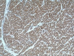 alpha Actinin Rabbit anti-Human, Mouse, Rat, Polyclonal, Proteintech:Anticorps:Anticorps