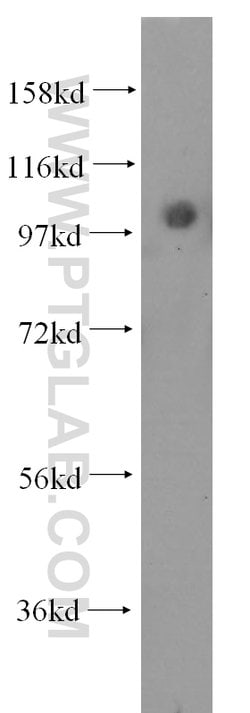 alpha Actinin Rabbit anti-Human, Mouse, Rat, Polyclonal, Proteintech:Anticorps:Anticorps