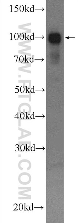 alpha Actinin Rabbit anti-Human, Mouse, Rat, Polyclonal, Proteintech:Anticorps:Anticorps