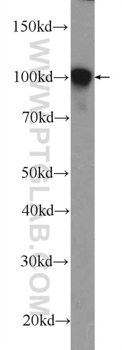 alpha Actinin Rabbit anti-Human, Mouse, Rat, Polyclonal, Proteintech:Anticorps:Anticorps