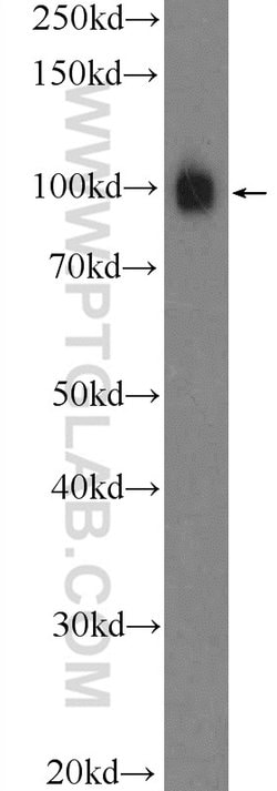 alpha Actinin Rabbit anti-Human, Mouse, Rat, Polyclonal, Proteintech:Anticorps:Anticorps