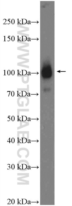 alpha Actinin Rabbit anti-Human, Mouse, Rat, Polyclonal, Proteintech:Anticorps:Anticorps