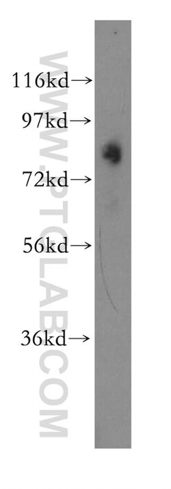 OSBPL11 Rabbit anti-Human, Mouse, Polyclonal, Proteintech 20 &mu;L; Unconjugated:Antibodies,