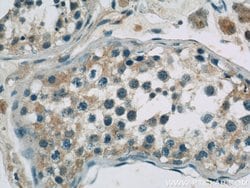 EIF2B4 Rabbit anti-Human, Mouse, Rat, Polyclonal, Proteintech:Antibodies:Primary