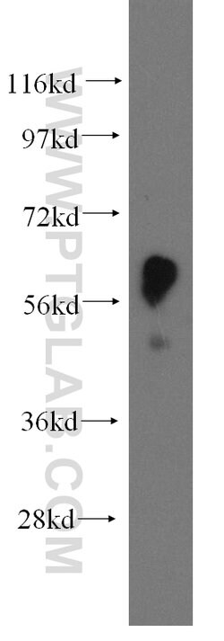 EIF2B4 Rabbit anti-Human, Mouse, Rat, Polyclonal, Proteintech:Antibodies:Primary