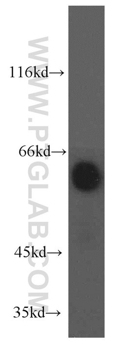 EIF2B4 Rabbit anti-Human, Mouse, Rat, Polyclonal, Proteintech:Antibodies:Primary