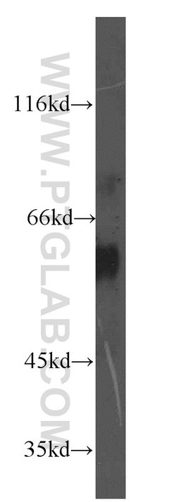 EIF2B4 Rabbit anti-Human, Mouse, Rat, Polyclonal, Proteintech:Antibodies:Primary