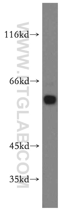 EIF2B4 Rabbit anti-Human, Mouse, Rat, Polyclonal, Proteintech:Antibodies:Primary