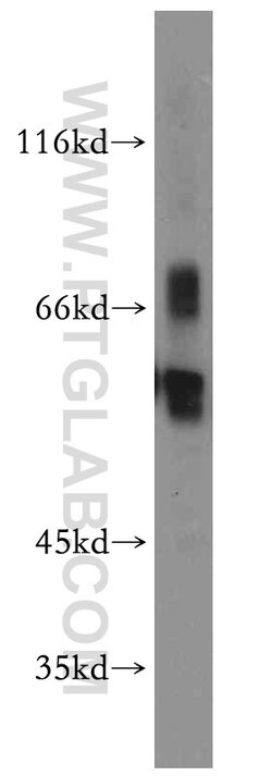 EIF2B4 Rabbit anti-Human, Mouse, Rat, Polyclonal, Proteintech:Antibodies:Primary