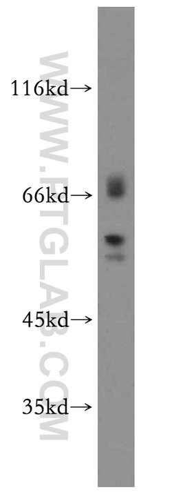 EIF2B4 Rabbit anti-Human, Mouse, Rat, Polyclonal, Proteintech:Antibodies:Primary