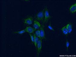 EIF2B4 Rabbit anti-Human, Mouse, Rat, Polyclonal, Proteintech:Antibodies:Primary