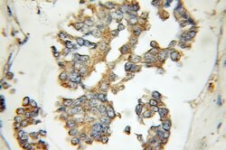 EIF2B4 Rabbit anti-Human, Mouse, Rat, Polyclonal, Proteintech:Antibodies:Primary