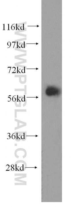 EIF2B4 Rabbit anti-Human, Mouse, Rat, Polyclonal, Proteintech:Antibodies:Primary