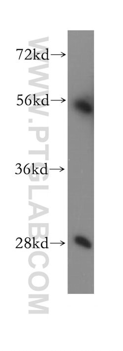 SUV39H2 Rabbit anti-Human, Mouse, Rat, Polyclonal, Proteintech 150 &mu;L;