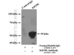 KRT81 Rabbit anti-Human, Mouse, Rat, Polyclonal, Proteintech 150 &mu;L;