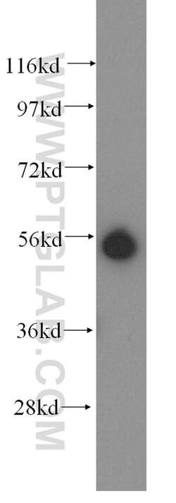 KRT81 Rabbit anti-Human, Mouse, Rat, Polyclonal, Proteintech 150 &mu;L;