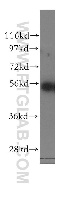 KRT81 Rabbit anti-Human, Mouse, Rat, Polyclonal, Proteintech 150 &mu;L;